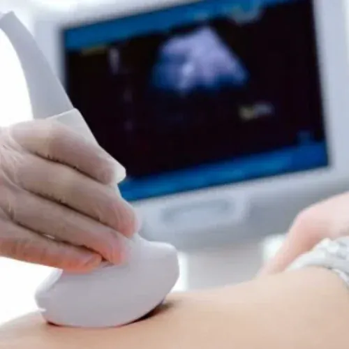 USG (Ultrasound)
